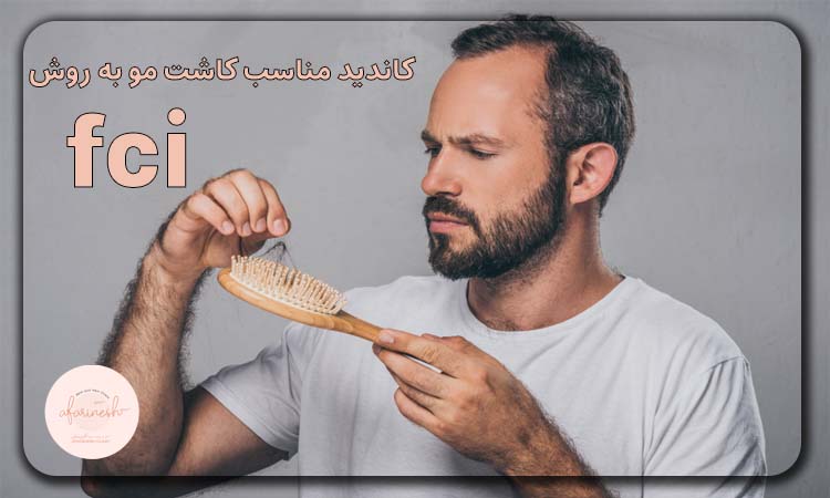 کاندید کاشت مو به روش fci