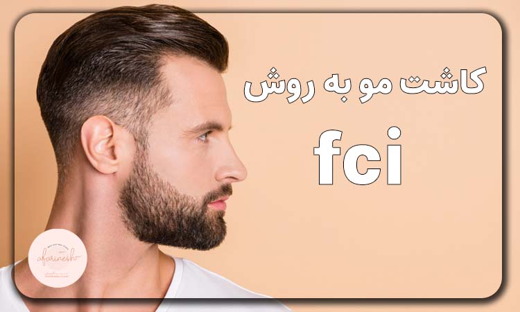 کاشت مو به روش fci