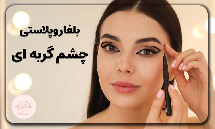 بلفاروپلاستی چشم گربه ای