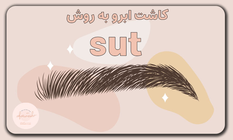کاشت ابرو به روش sut