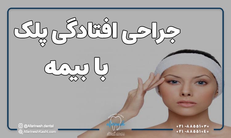 جراحی افتادگی پلک با بیمه