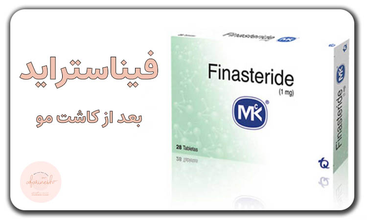 فیناستراید بعد از کاشت مو