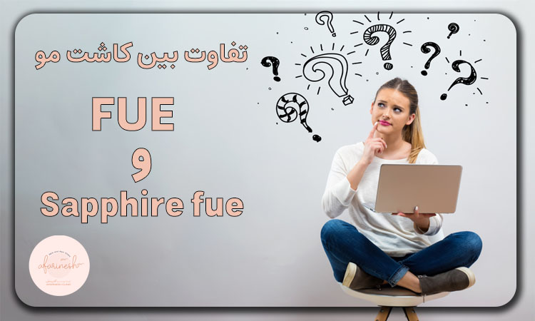 تفاوت بین کاشت مو FUE و Sapphire fue