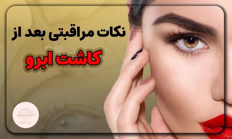 نکات مراقبتی بعد کاشت ابرو