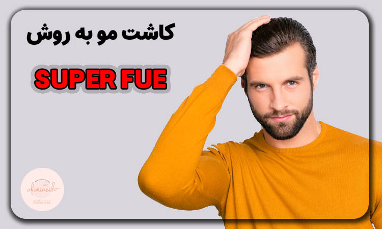 کاشت مو به روش super fue چیست؟