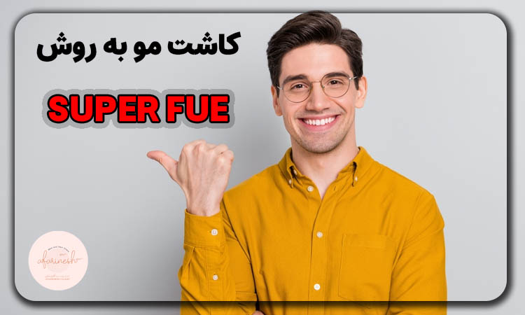 کاشت مو به روش super fue