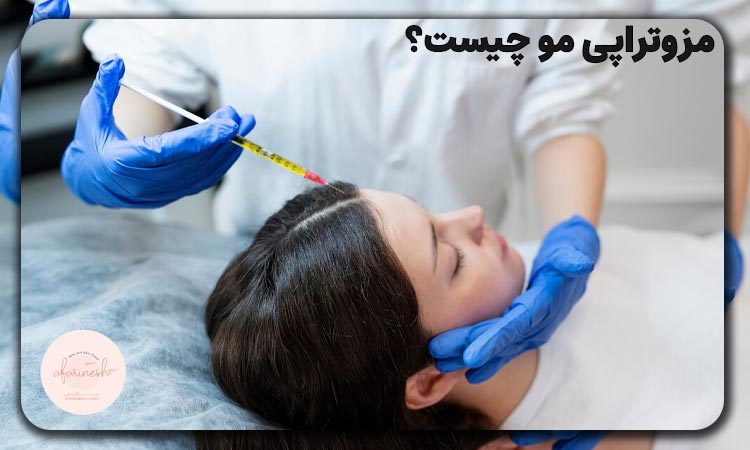 مزوتراپی مو چیست