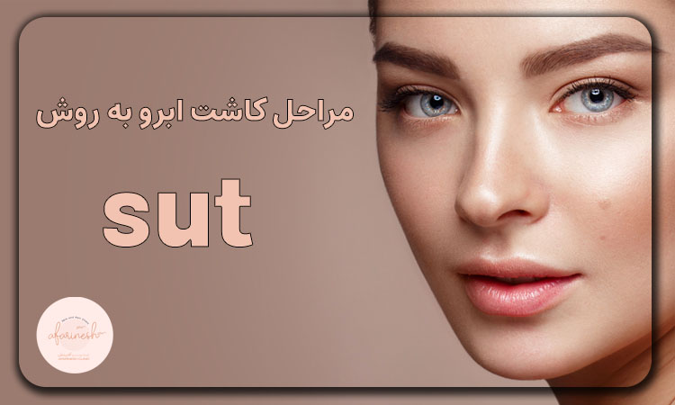 مراحل کاشت ابرو به روش sut