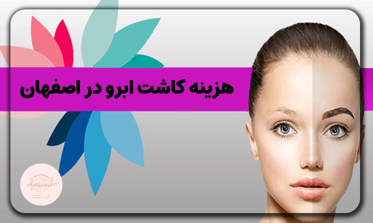 هزینه کاشت ابرو در اصفهان