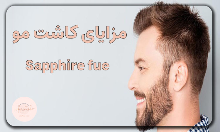 مزایای کاشت مو sapphire fue