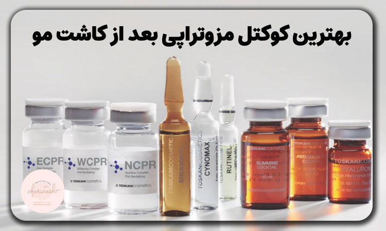 بهترین کوکتل مزوتراپی بعد از کاشت مو
