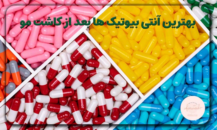 بهترین آنتی بیوتیک ها بعد از کاشت مو