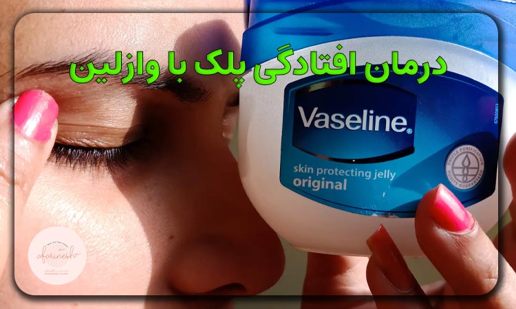 وازلین برای افتادگی پلک