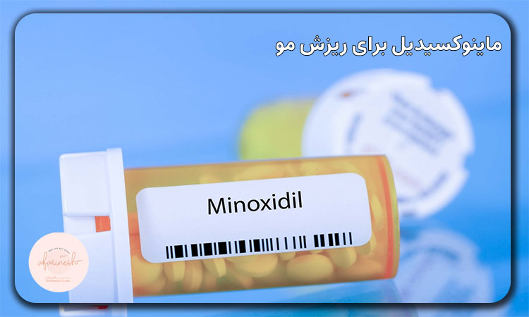 ماینوکسیدیل برای ریزش مو