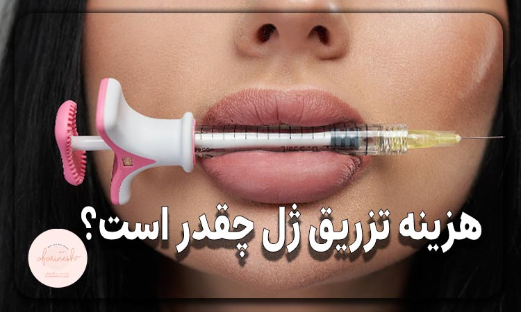 هزینه تزریق ژل