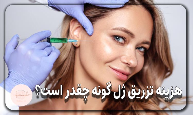 هزینه تزریق ژل گونه