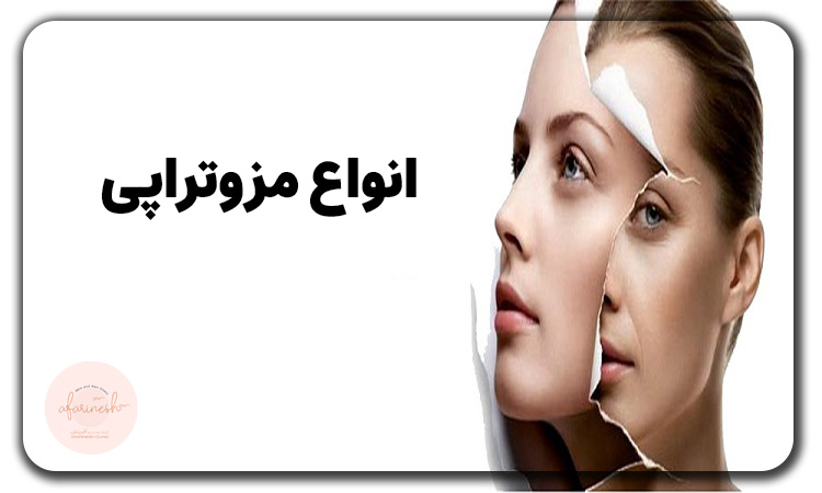 انواع مزوتراپی شامل چه مواردی می‌شود؟