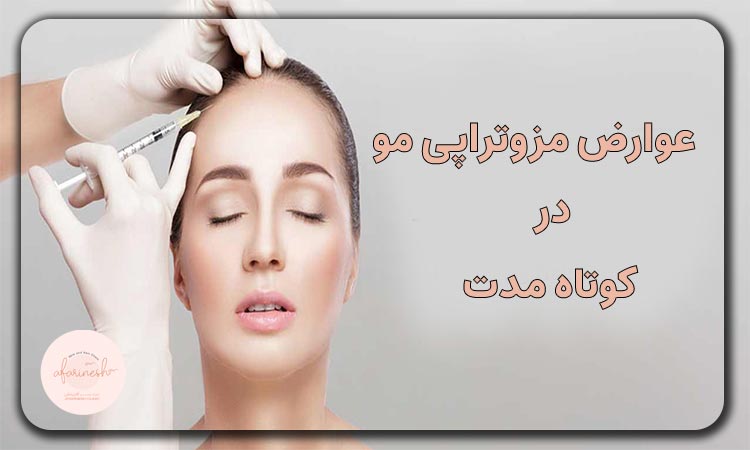 عوارض مزوتراپی مو در کوتاه مدت