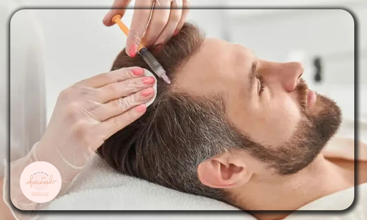 آیا مزوتراپی مو دردناک است؟