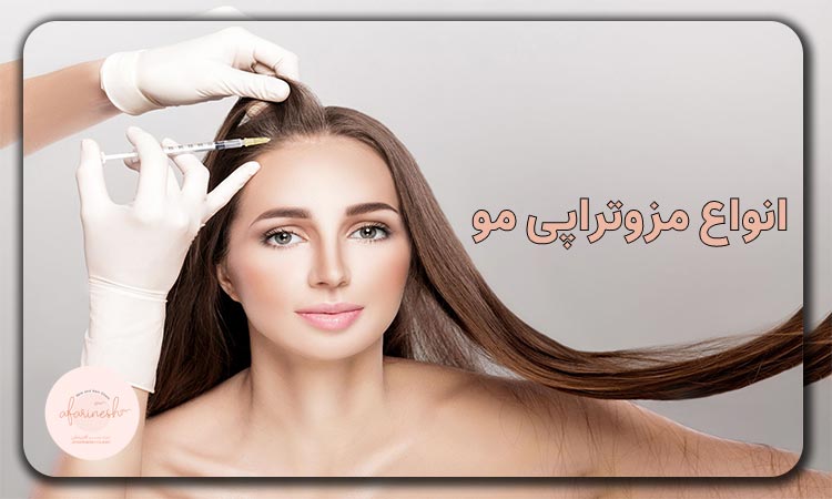 انواع مزوتراپی مو