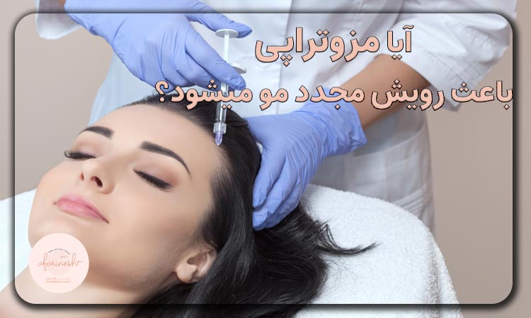 رشد مجدد مو با مزوتراپی