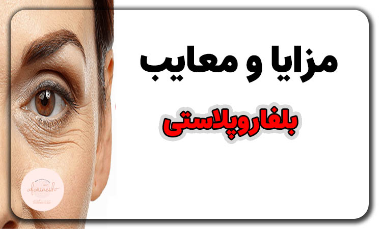 مزایا و معایب بلفاروپلاستی
