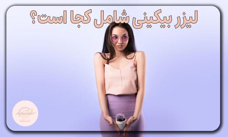 لیزر بیکینی شامل کجا است