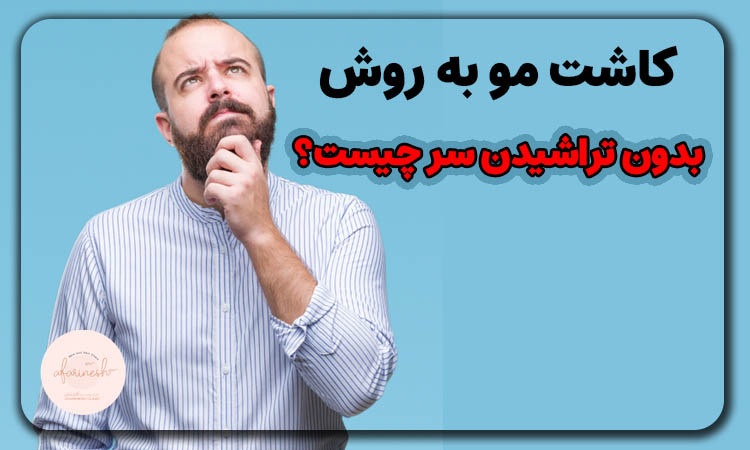 کاشتن مو بدون تراشیدن سر چیست؟