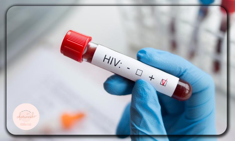 هپاتیت و hiv
