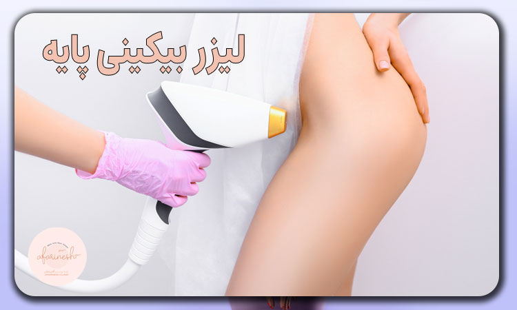 لیزر بیکینی پایه
