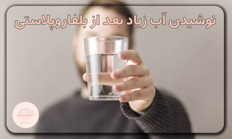 نوشیدن آب زیاد بعد بلفاروپلاستی