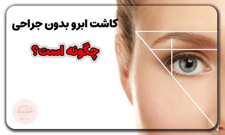 کاشت ابرو بدون جراحی چگونه است