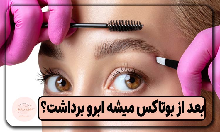 بعد از بوتاکس میشه ابرو برداشت