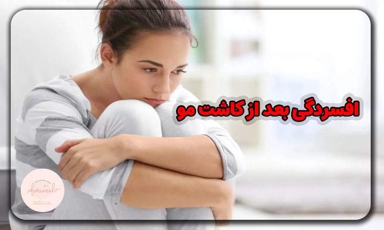 افسردگی بعد از کاشت مو