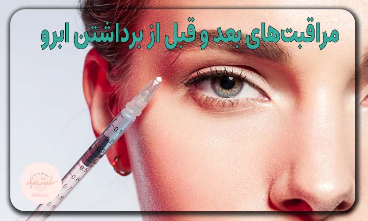 مراقبتهای بعد و قبل از برداشتن ابرو