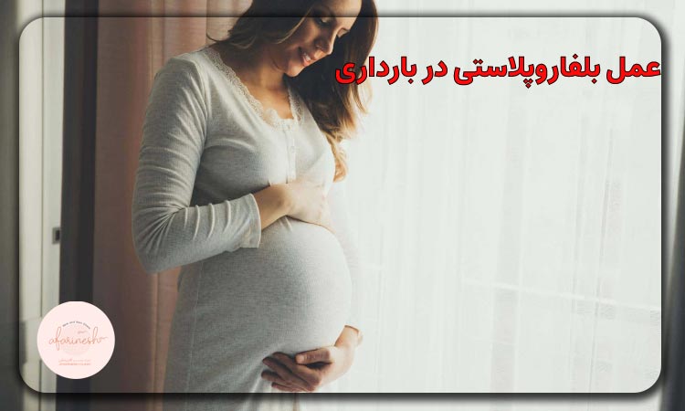 عمل بلفاروپلاستی در بارداری