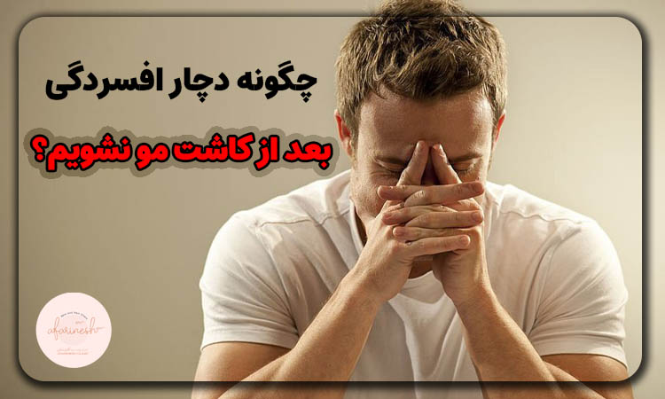 چگونه دچار افسردگی بعد از کاشت مو نشویم؟