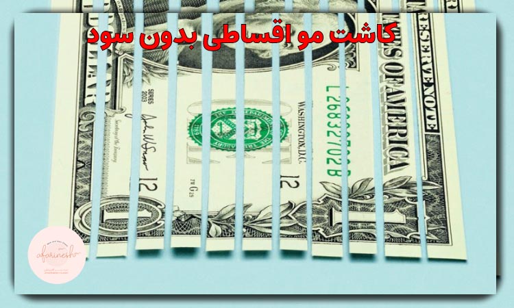 کاشت مو اقساطی