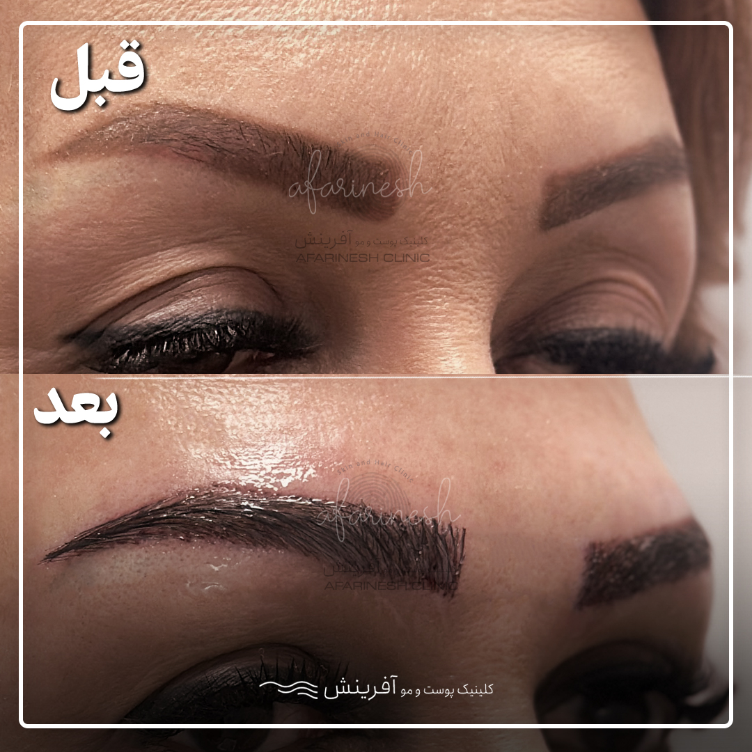 عکس ابرو دخترانه برای صورت گرد
