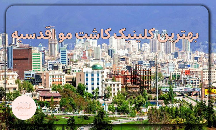 کاشت مو اقدسیه