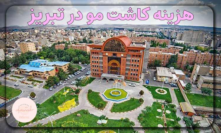 هزینه کاشت مو در تبریز