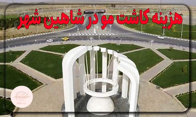 هزینه کاشت مو در شاهین شهر
