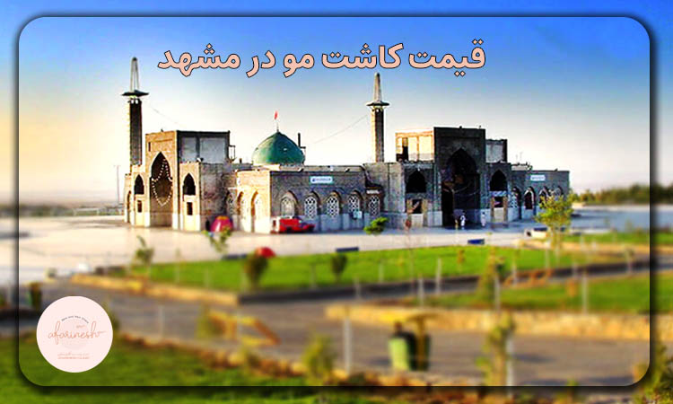 هزینه کاشت مو در مشهد
