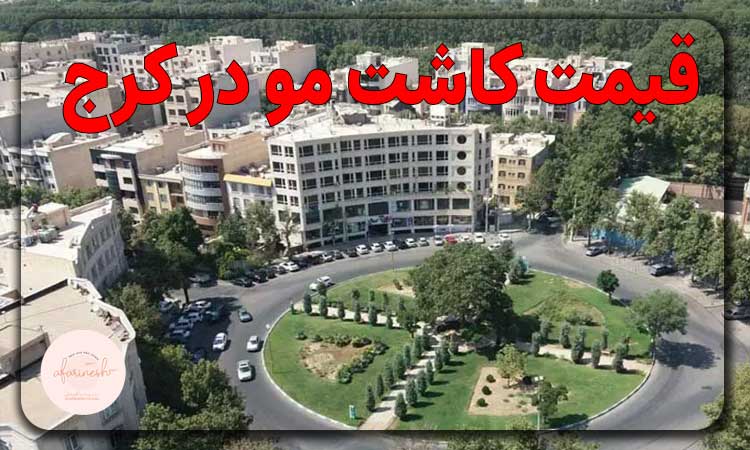 قیمت کاشت مو در کرج