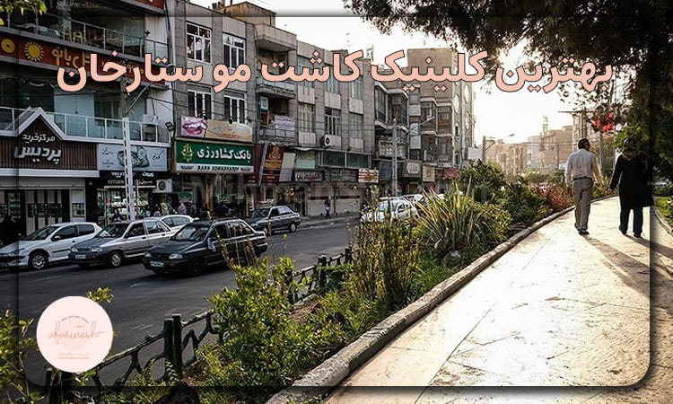 کاشت مو ستارخان