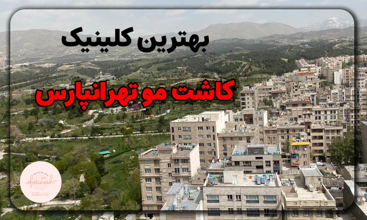 کاشت مو تهرانپارس
