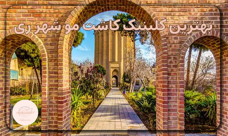 بهترین کلینیک کاشت مو شهر ری