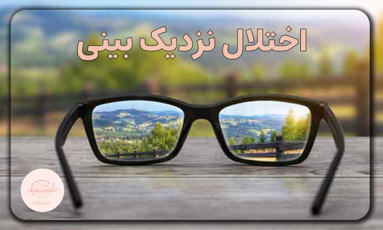 اختلال نزدیک‌بینی