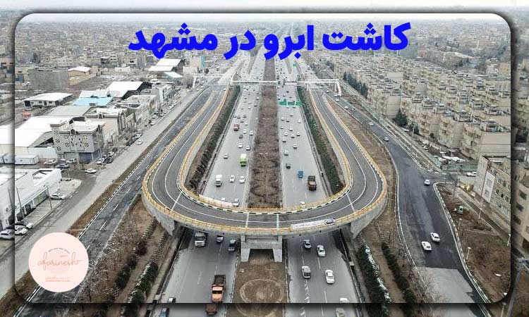 کاشت ابرو در مشهد