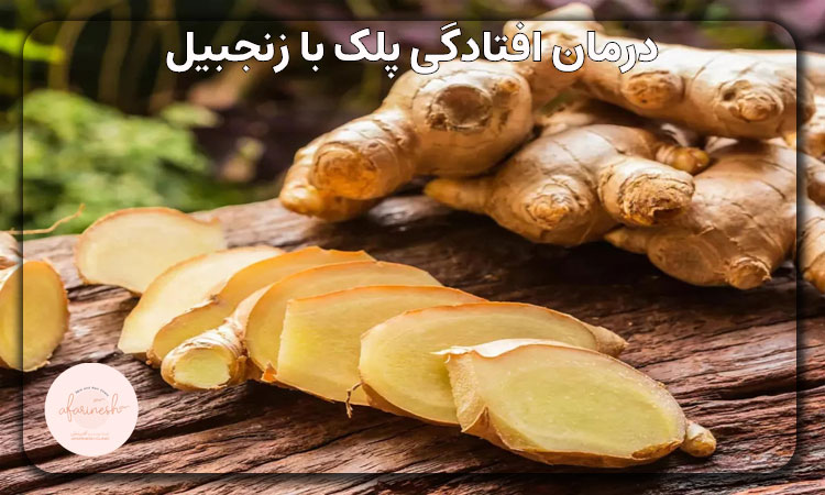درمان افتادگی پلک با زنجبیل